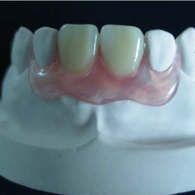 Dents antérieures nesbit valplast